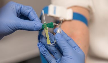 Οι 7 εξετάσεις που οι γιατροί λένε ότι δεν πρέπει να αμελούμε μετά τα 40