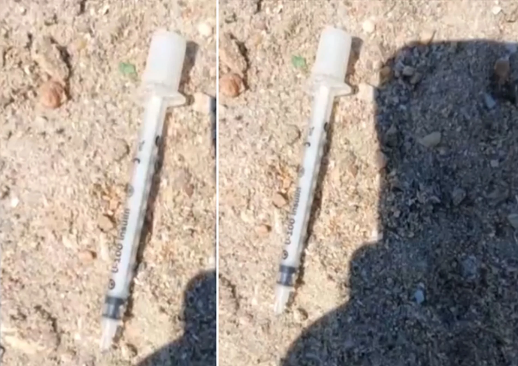 Θεσσαλονίκη: Παιδί πάτησε σύριγγα σε παραλία στους Νέους Επιβάτες