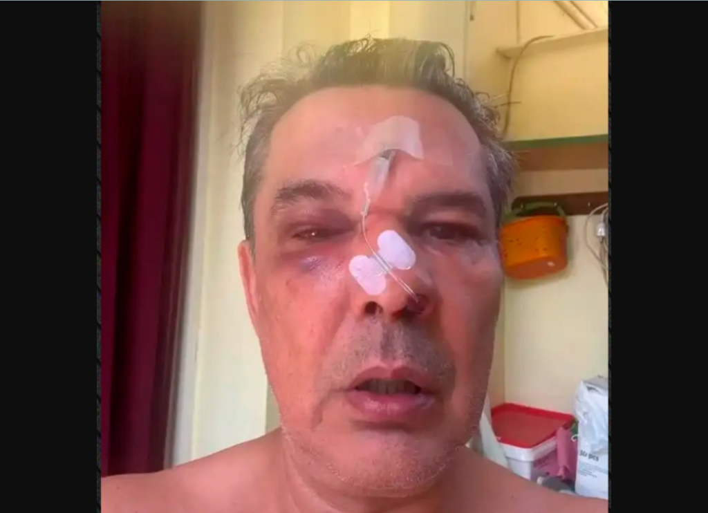 Άγριος ξυλοδαρμός άνδρα από λογιστή μέσα σε ιατρείο στο Χαϊδάρι: Του «μαύρισε» το μάτι για ασήμαντη αφορμή (βίντεο)