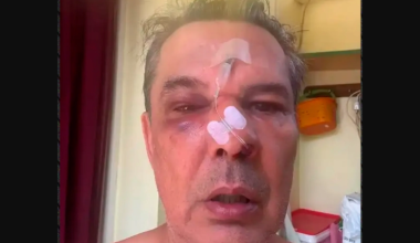 Άγριος ξυλοδαρμός άνδρα από λογιστή μέσα σε ιατρείο στο Χαϊδάρι: Του «μαύρισε» το μάτι για ασήμαντη αφορμή (βίντεο)