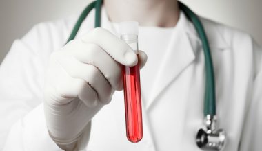 Νέα εξέταση αίματος εντοπίζει τον καρκίνο του παγκρέατος στα πρώτα του στάδια