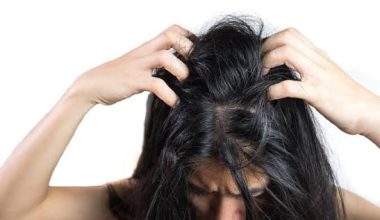 Φαγούρα στο κεφάλι το καλοκαίρι: Γιατί εμφανίζεται και πώς αντιμετωπίζεται