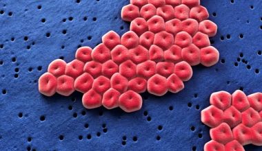 Acinetobacter baumannii: Το υπερβακτήριο που «αντέχει» στα αντιβιοτικά και περνά από τα κατοικίδια στον άνθρωπο