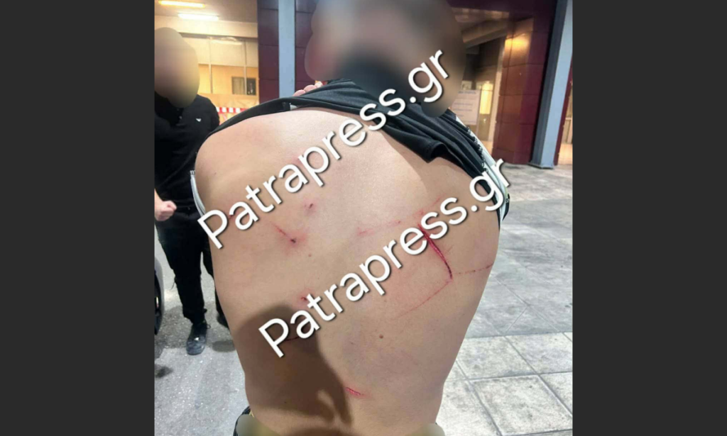Ρίο: Χτύπησαν 18χρονο με κατσαβίδι 13 φορές και πήγαν να τον πετάξουν στη θάλασσα!