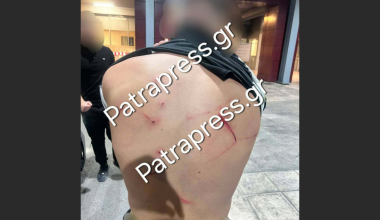 Ρίο: Χτύπησαν 18χρονο με κατσαβίδι 13 φορές και πήγαν να τον πετάξουν στη θάλασσα!