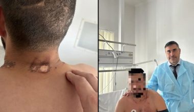 Το «θρίλερ» επιβίωσης ενός Ρώσου στρατιώτη – Χτύπημα από κεραυνό, επίθεση αρκούδας και παράλυση