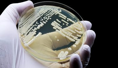 Candida auris: Ο μύκητας που «κρύβεται» στους θύλακες των τριχών και επιμένει στο δέρμα