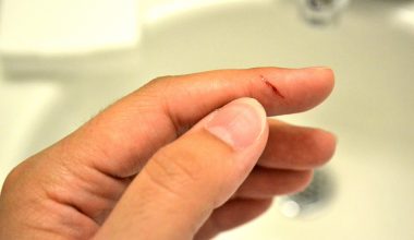 Γιατί ένα μικρό κόψιμο από χαρτί πονάει τόσο πολύ;