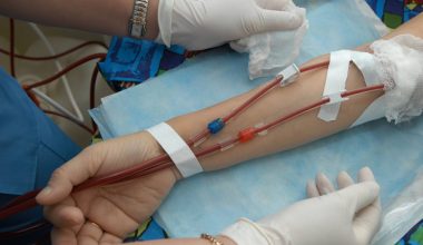Νεφροπαθής ζει με νεφρό από γενετικά τροποποιημένο χοίρο εδώ και 271 μέρες!