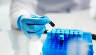 Πλασμαφαίρεση και αιμοκάθαρση: Ποια είναι η κρίσιμη διαφορά μεταξύ των δύο διαδικασιών;