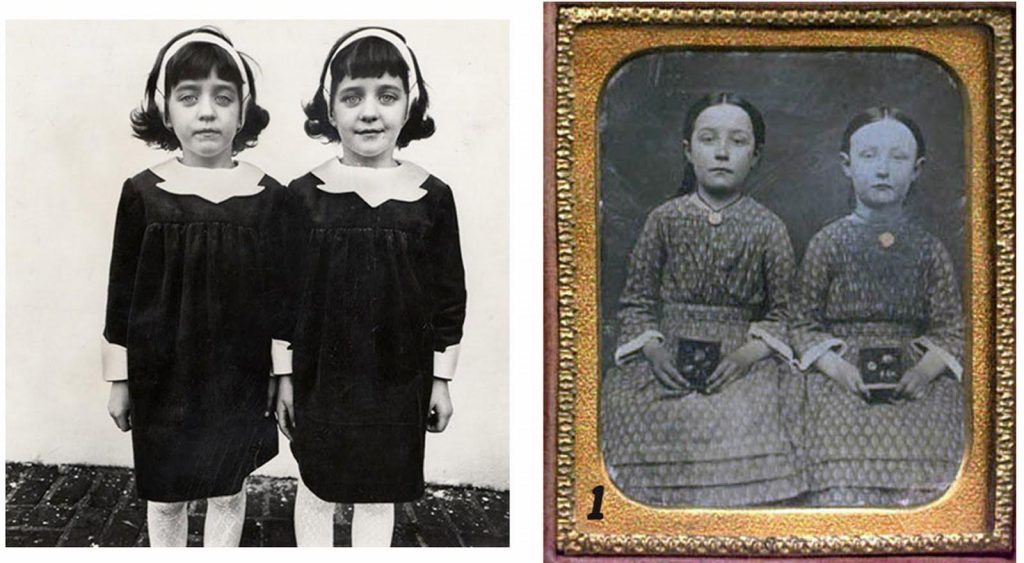 Το μυστήριο του «Pollock Twins» – Η παράξενη ιστορία που συνδέθηκε με τη συζήτηση για τη μετενσάρκωση