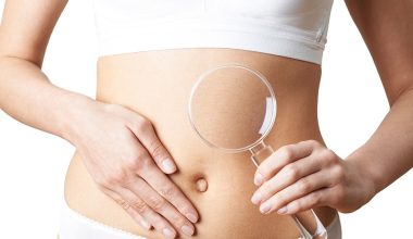 Αυξημένα εντερικά αέρια: Oι πιο συνηθισμένες αιτίες και πότε πρέπει να απευθυνθείτε σε γιατρό