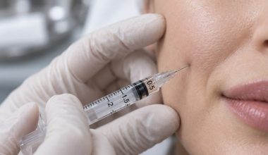 Καταγγελία για «μαϊμού» γιατρό που έκανε μπότοξ & fillers στο σπίτι: «Παραμορφώθηκαν τα χείλη μου»
