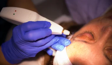 Θεσσαλονίκη: Γυναίκα πήγε για δωρεάν καθαρισμό και κατέληξε με πρόβλημα στην όραση