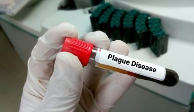 Ρωσία: Διαψεύδει δεύτερο κρούσμα πανώλης σε εργαστήριο στη Σιβηρία