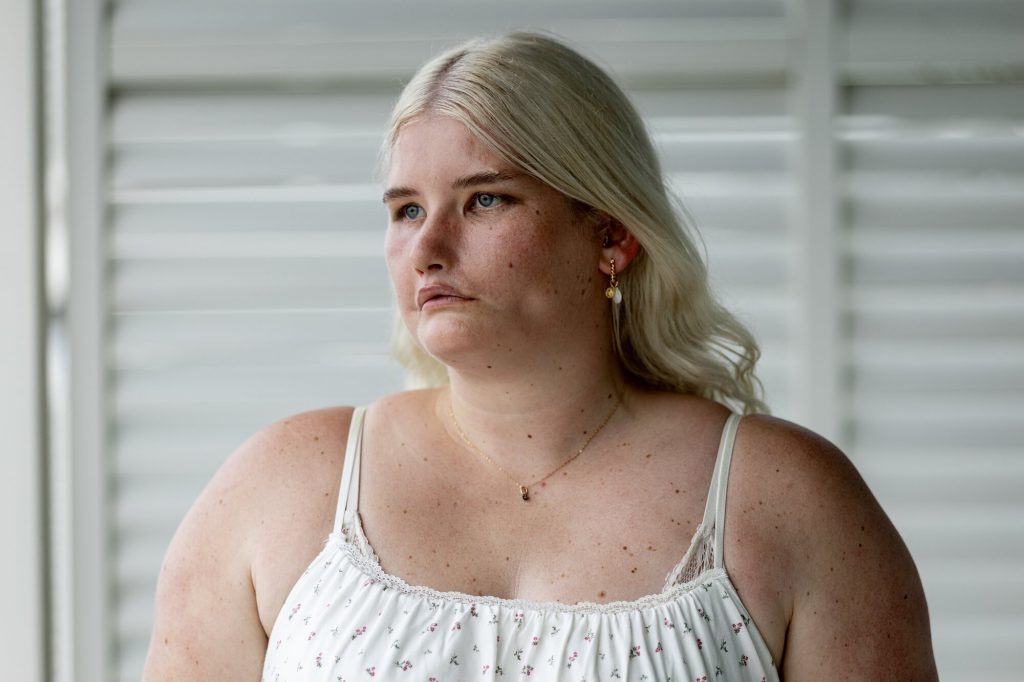 Tayla Clement: Η 28χρονη influencer που δεν μπορεί να χαμογελάσει – Το σπάνιο σύνδρομο Moebius