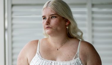 Tayla Clement: Η 28χρονη influencer που δεν μπορεί να χαμογελάσει – Το σπάνιο σύνδρομο Moebius