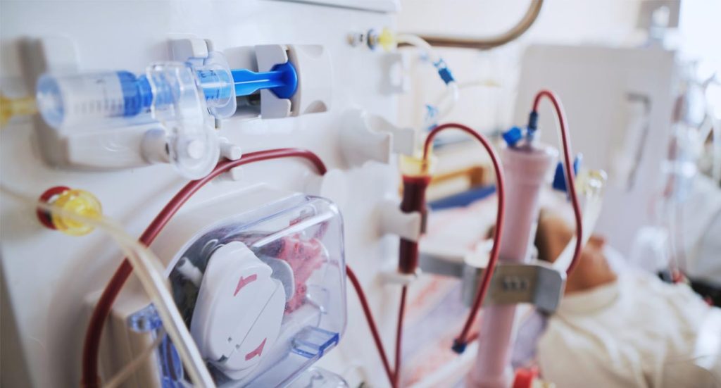 Χαλκιδική: 51χρονη πέθανε κατά τη διάρκεια αιμοκάθαρσης σε ιδιωτική κλινική
