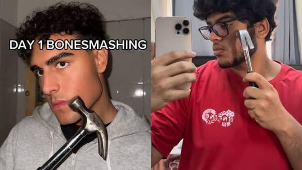 «Bonesmashing»: Η επικίνδυνη τάση της Gen Z στη Ρωσία – Κτυπούν το πρόσωπό τους με σφυριά!