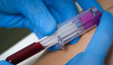 Σάλος στην Κίνα: Nοσηλευτής εμβολίασε 78 παιδιά για φυματίωση με την ίδια βελόνα!